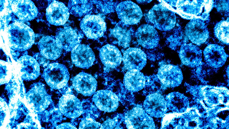 Mikroskopische Aufnahme des Coronavirus der für COVID-19 verantwortlich ist